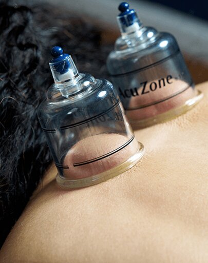 Pain management acupuncture service